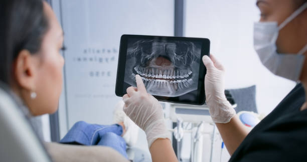 Licensed Tooth Extraction service in Orlando, FL - Smile Center Dentistry